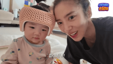 نشرت سون دام بي صوراً لابنتها البالغة من العمر 8 أشهر قبل وبعد 5 أسابيع من عملية تصحيح شكل الرأس نشرت سون دام بي صوراً لابنتها البالغة من العمر 8 أشهر قبل وبعد 5 أسابيع من عملية تصحيح شكل الرأس