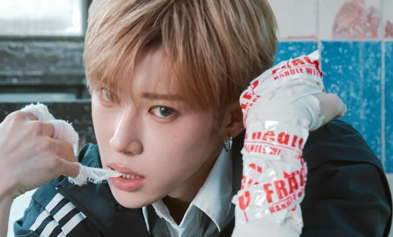 أرنو من فرقة ALPHA DRIVE ONE سيغيب جزئياً عن أنشطة ترسيمه بعد تعرضه لكسر