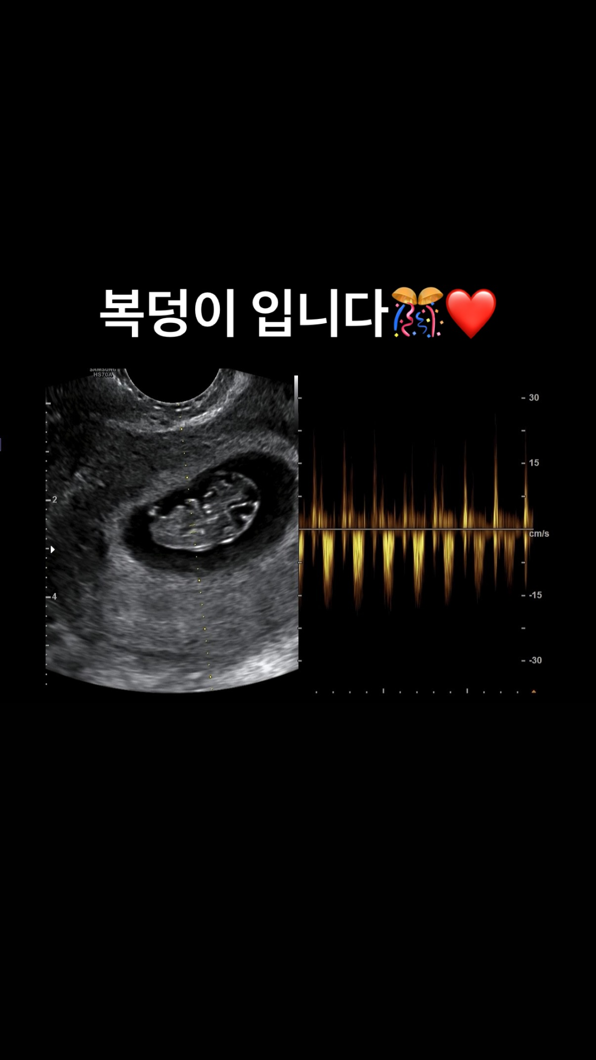 غو ووري من Rainbow تعلن عن حملها